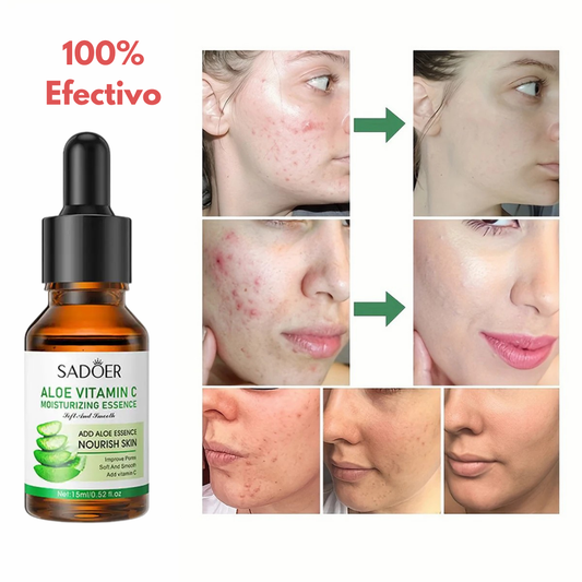 Sérum Aloe vera Piel joven y radiante  +  Masajeador Quita Papada y Arrugas TOTALMENTE GRATIS