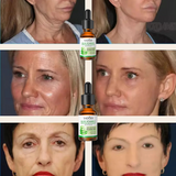 Sérum Aloe vera Piel joven y radiante  +  Masajeador Quita Papada y Arrugas TOTALMENTE GRATIS